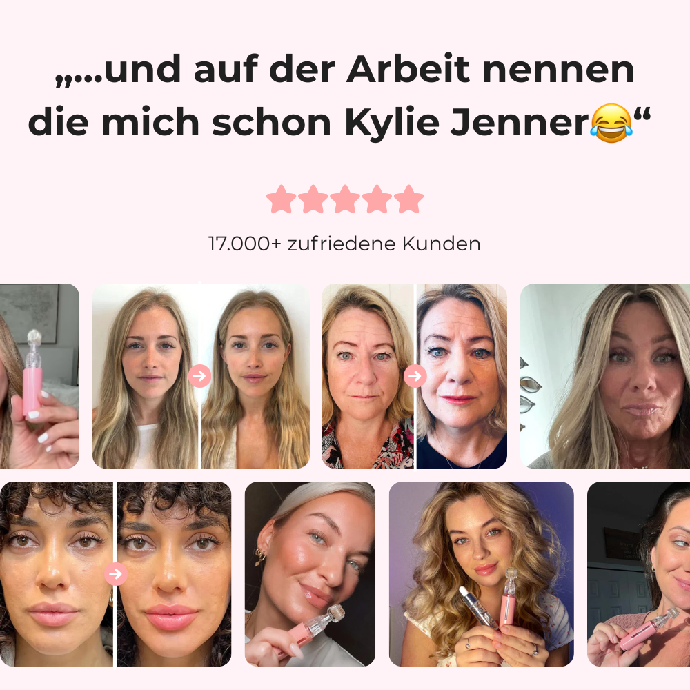 LipBoost Set - Kusslippen ohne Spritzen